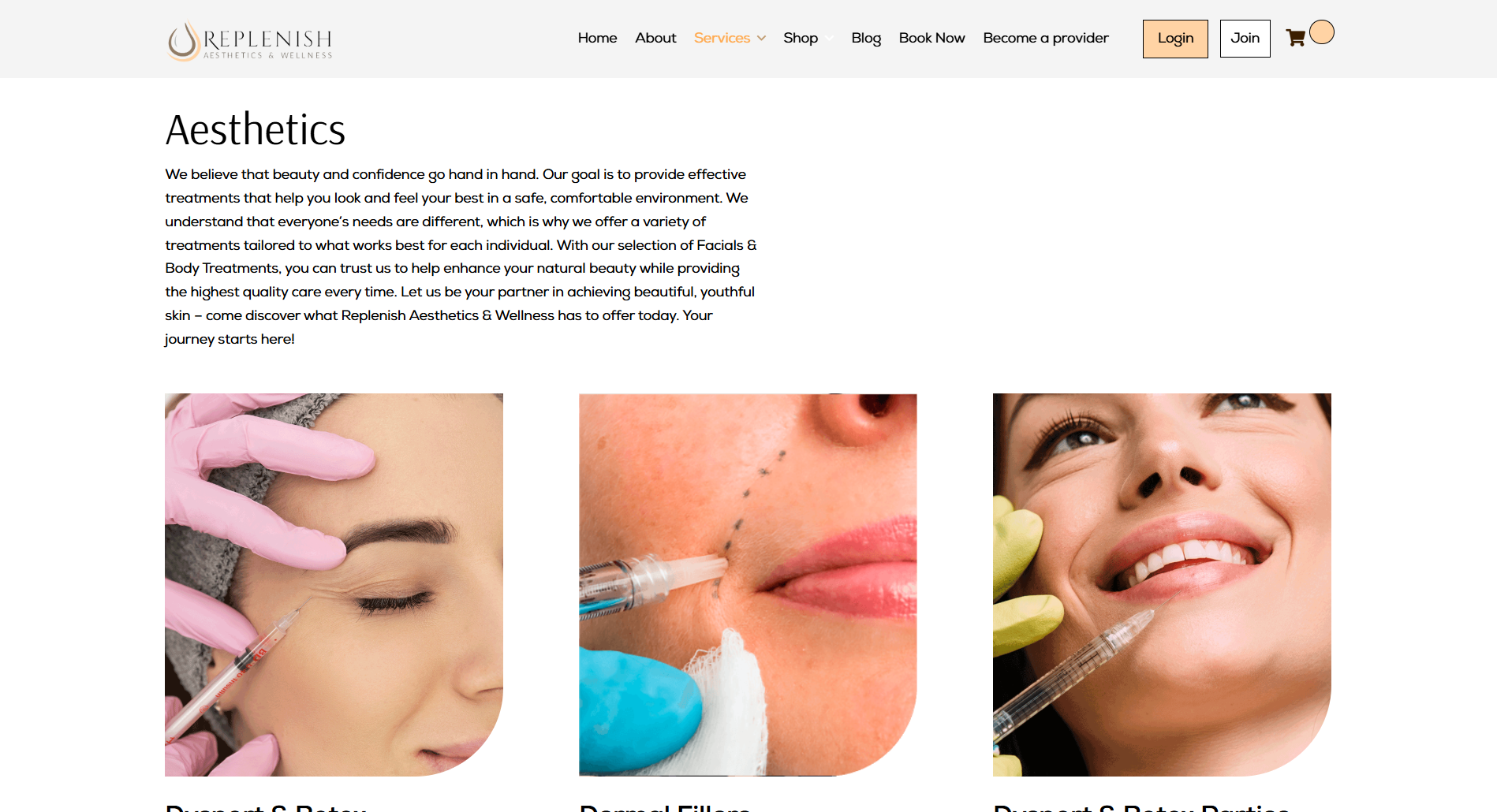 Replenish MD view 2